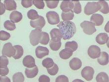 犬巴貝斯焦蟲病