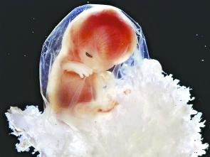 十周大的胎兒