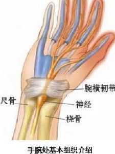 手腕韌帶拉傷 手腕韌帶拉傷
