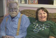 圖(左)的人  不是藍血人