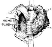 喉返神經和甲狀旁腺的位置