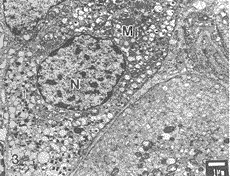 嗜鈣水綿中形變型 嗜鈣水綿中形變型