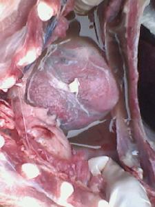 類肺炎性胸腔積液