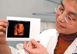 （圖）胎兒寫真