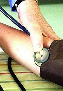 雙臂血壓差 雙臂血壓差