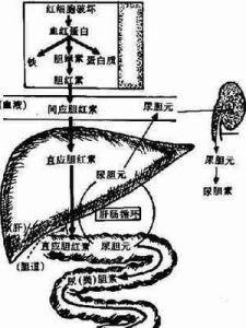 間接膽紅素 間接膽紅素
