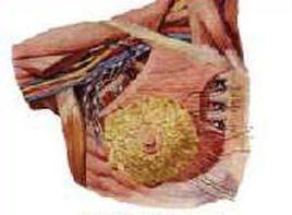 乳房硬化 乳房硬化