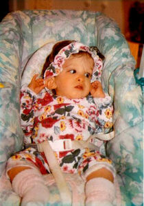 美國女孩患X綜合症