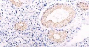 慢性萎縮性胃炎