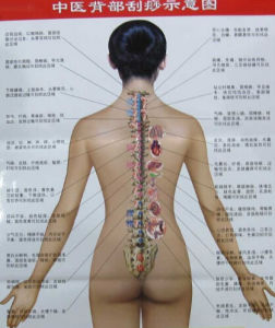 中醫背部刮痧示意圖 中醫背部刮痧示意圖