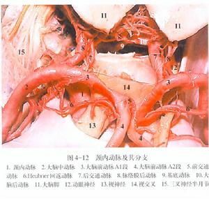 頸內動脈及其分支