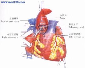 主動脈瓣閉鎖不全