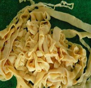 莫尼茨絛蟲 莫尼茨絛蟲