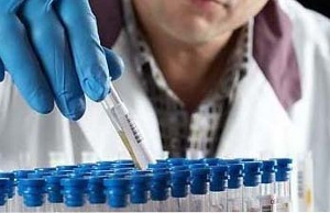 B肝145陽性 B肝145陽性