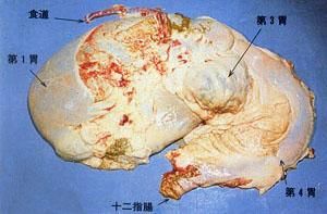 瓣胃阻塞 瓣胃阻塞