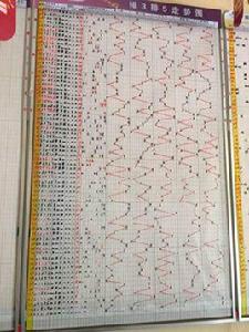 彩票走勢圖 彩票走勢圖