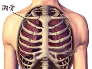 胸骨骨折 胸骨骨折