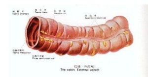 結腸擴張 結腸擴張