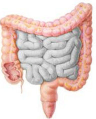 粘連性腸梗阻 粘連性腸梗阻