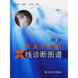 骨關節創傷X線診斷圖譜(第2版) 骨關節創傷X線診斷圖譜(第2版)