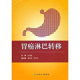 胃癌淋巴轉移 胃癌淋巴轉移