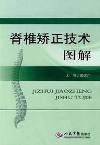 脊椎矯正技術圖解 脊椎矯正技術圖解
