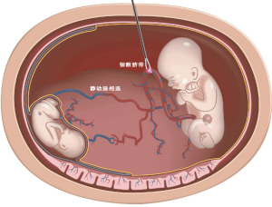 出生前的胎兒