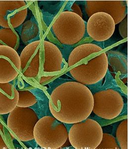 圖譜說明:標題：構巢麴黴的菌絲和有性孢子的電鏡圖片