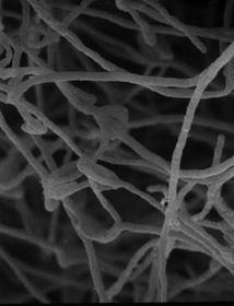 出生鏈黴菌 出生鏈黴菌