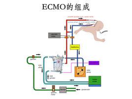 ECMO--體外膜肺氧合 ECMO--體外膜肺氧合