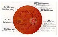 老年黃斑變性 老年黃斑變性