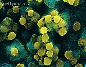 鏈球菌性咽炎