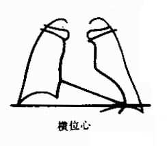 橫位心 橫位心
