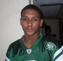 患上血淚怪病的美國男孩加爾維諾&middot;因曼