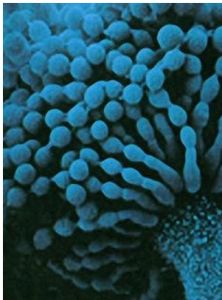 黴菌感染 黴菌感染