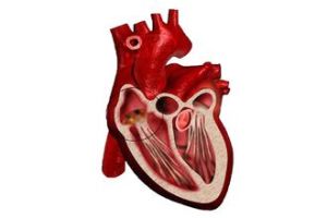 心臟內膜炎 心臟內膜炎