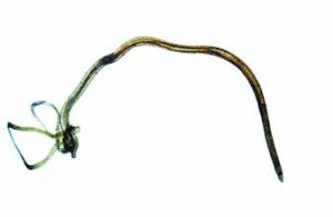 廣州管圓線蟲病