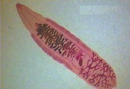 肝寄生蟲 肝寄生蟲