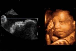 先天性疾病 先天性疾病