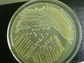 hat培養基 hat培養基