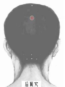 後頂穴