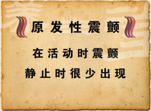 原發性震顫 原發性震顫
