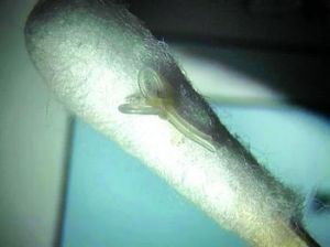 結膜吸吮線蟲 結膜吸吮線蟲