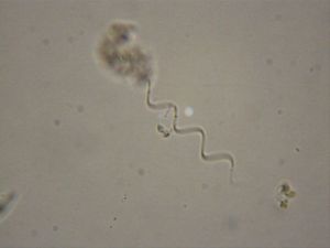 中華尖頭藻 中華尖頭藻