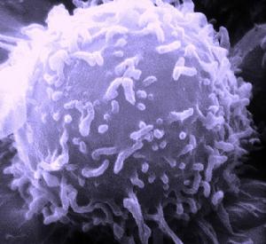 電子顯微鏡下的淋巴細胞，是人體免疫系統的主要組成。
