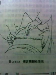 液波震顫 液波震顫