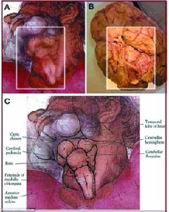 壁畫中上帝的脖子（A）畫得十分精細，紋理與大腦解剖圖（B）吻合。