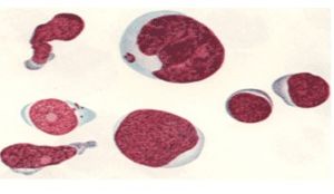 淋巴細胞系統 淋巴細胞系統