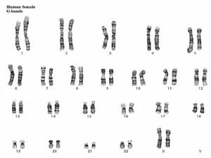 染色體性別 染色體性別