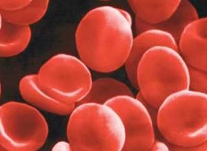 重度貧血 重度貧血